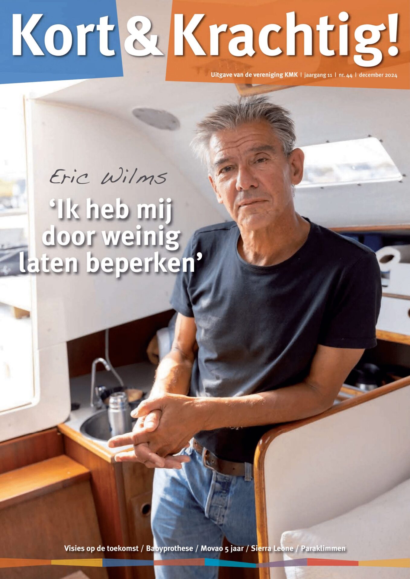 Patiëntenvereniging korte arm, kort been of amputatie 2 man met gitaar en bionische prothese